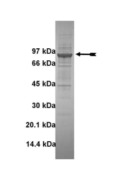 Eurofins DiscoverX Fes/Fps Protein, Active 10 &mu;g | Buy Online | Eurofins DiscoverX | Fisher Scientific